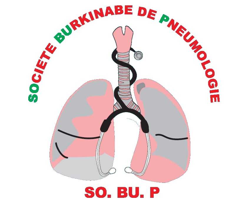 SOBUP